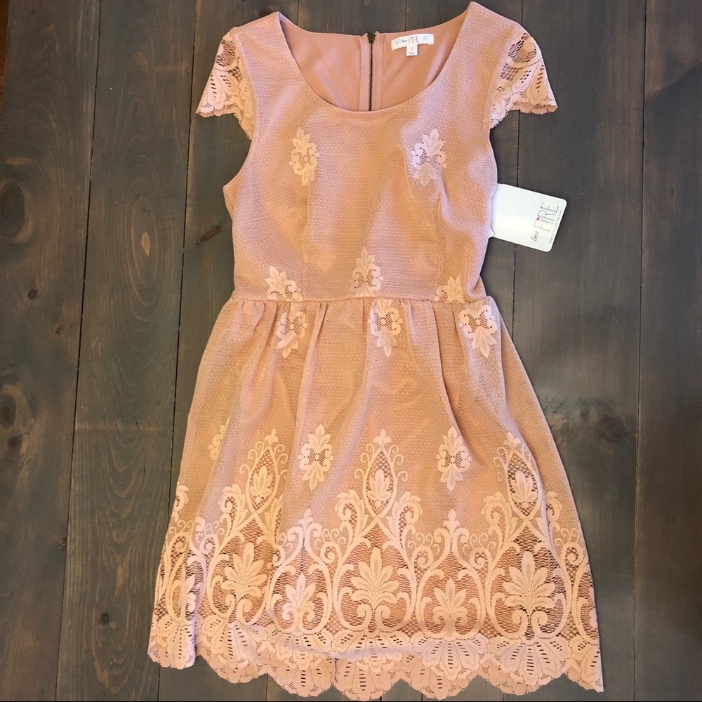 Scalloped Hem Lace Dress